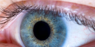 Czym jest zmętnienie soczewki oka