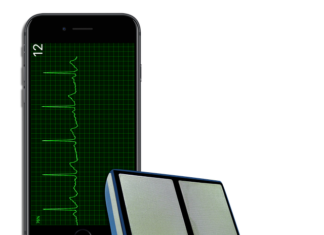 wykres ekg