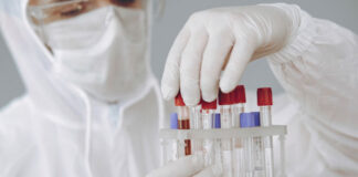 Gdzie mogę zrobić bezpiecznie test na koronawirusa